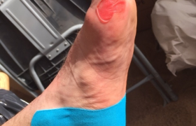 Alexandre Gély Podologue Posturologue à Hyères (83400)